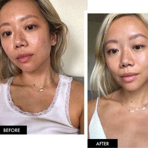 Retinol Before and After: Transform Your Skin with These Results 30 Retinol Before and After: Transform Your Skin with These Results