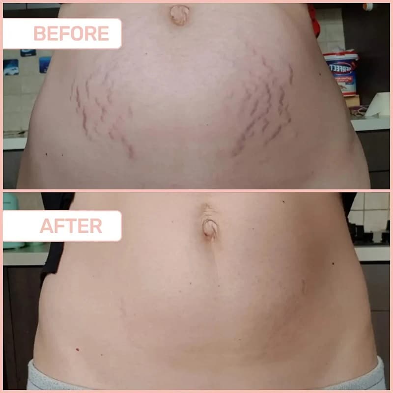 Maelys Cosmetics Before and After: A Comprehensive Review of the Results 31 Maelys Cosmetics Before and After: A Comprehensive Review of the Results