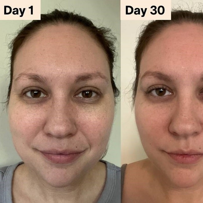 Red Light Therapy Before and After: Does It Really Work? 31 Red Light Therapy Before and After: Does It Really Work?