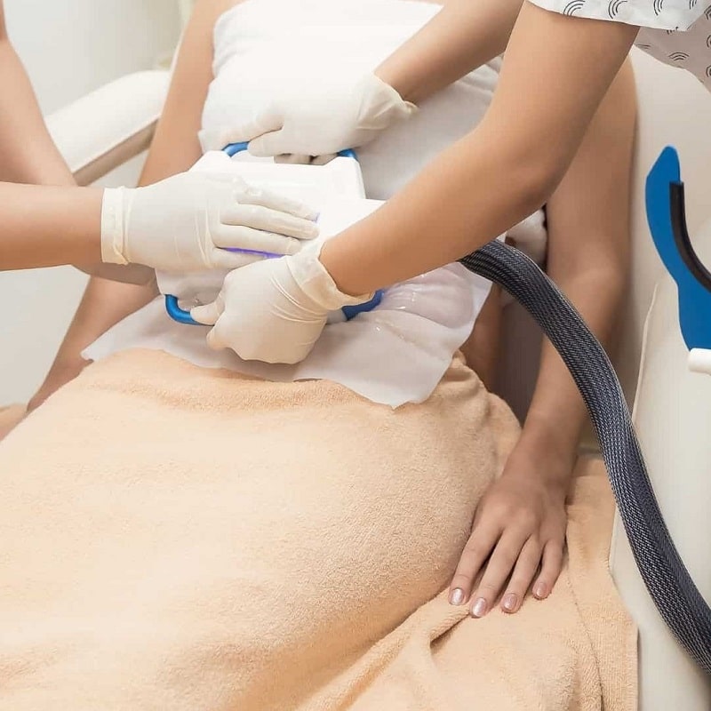 Coolsculpting Before and After: Results, Side Effects, and What to Expect 36 Coolsculpting Before and After: Results, Side Effects, and What to Expect
