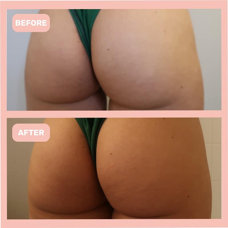 Maelys Cosmetics Before and After: A Comprehensive Review of the Results 5 Maelys Cosmetics Before and After: A Comprehensive Review of the Results