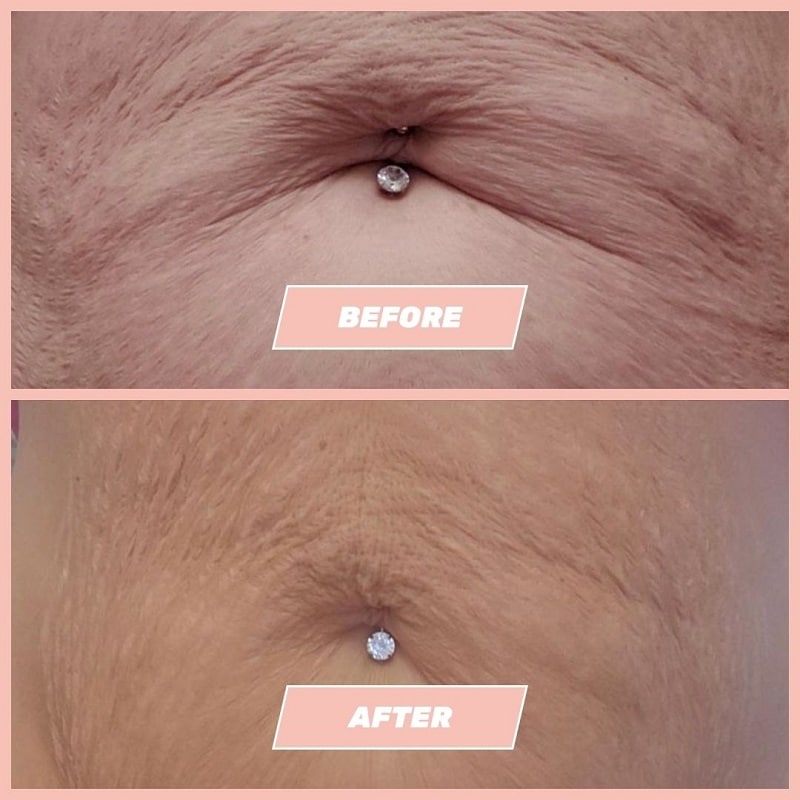 Maelys Cosmetics Before and After: A Comprehensive Review of the Results 6 Maelys Cosmetics Before and After: A Comprehensive Review of the Results