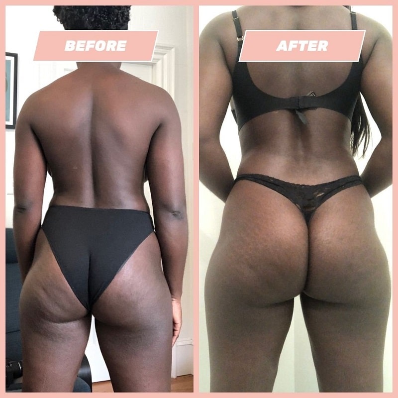 Maelys Cosmetics Before and After: A Comprehensive Review of the Results 8 Maelys Cosmetics Before and After: A Comprehensive Review of the Results