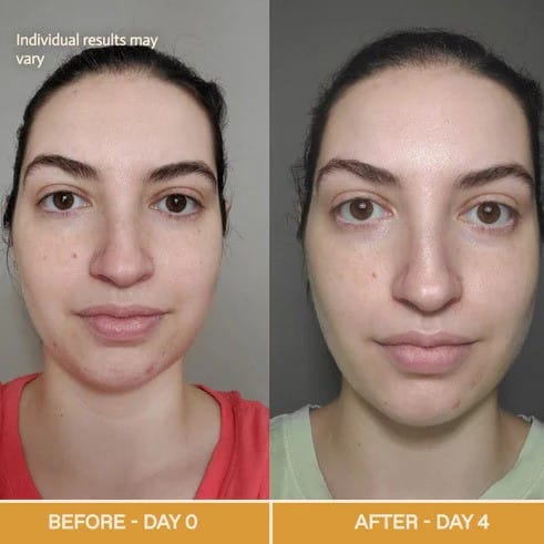 Red Light Therapy Before and After: Does It Really Work? 8 Red Light Therapy Before and After: Does It Really Work?