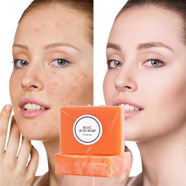 Kojic Acid Soap Before and After Does It Really Lighten Skin? Must