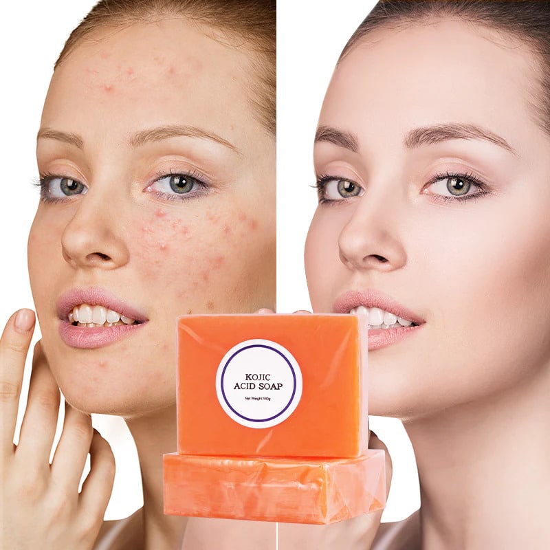 Kojic Acid Soap Before and After: Does It Really Lighten Skin?