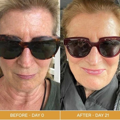 Red Light Therapy Before and After: Does It Really Work? 9 Red Light Therapy Before and After: Does It Really Work?