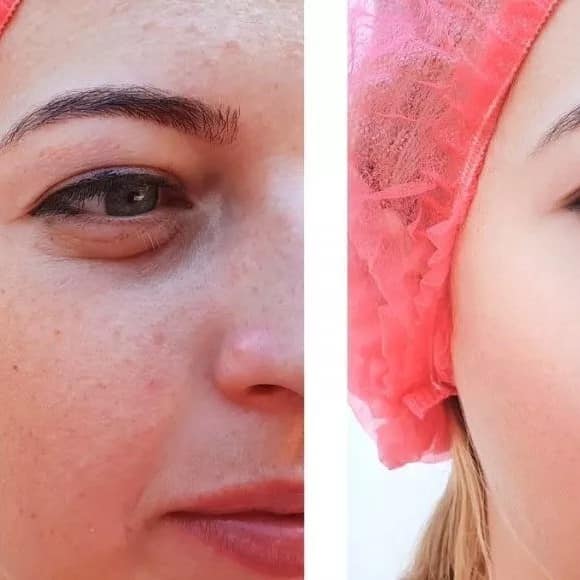 Kojic Acid Soap Before and After: Does It Really Lighten Skin? 10 Kojic Acid Soap Before and After: Does It Really Lighten Skin?