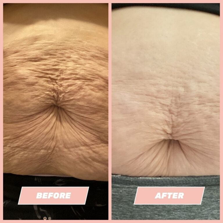 Maelys Cosmetics Before and After A Comprehensive Review of the Results Must Read This Before