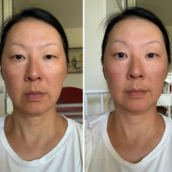 Gua Sha Before and After: Benefits and Results