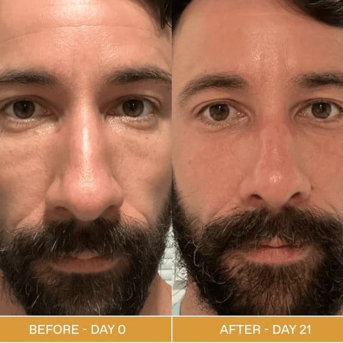 Red Light Therapy Before and After: Does It Really Work? 10 Red Light Therapy Before and After: Does It Really Work?