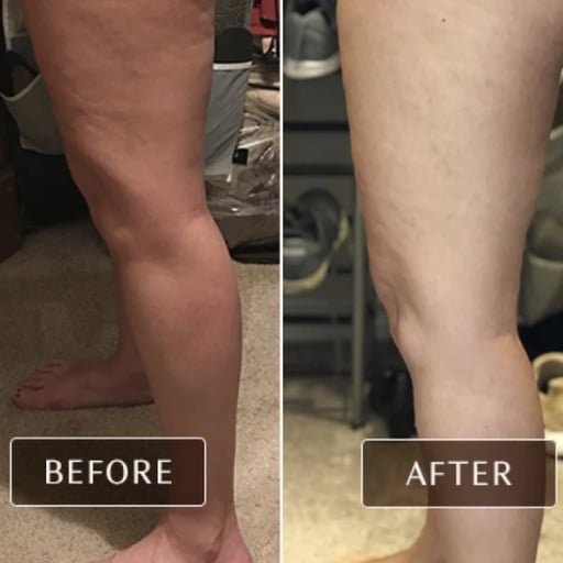 Ashley Black FasciaBlaster Review