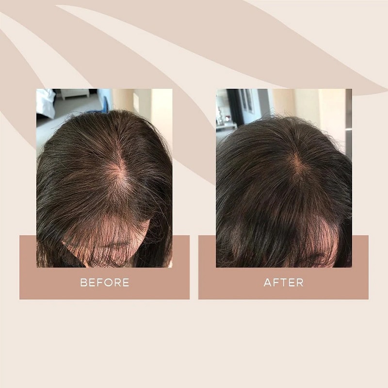 Vegamour Before and After: Real Results or Hype?