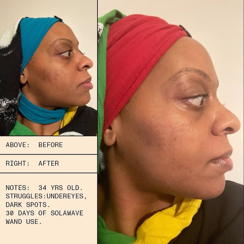 Solawave Before and After: A Comprehensive Analysis of the Results 16 Solawave Before and After: A Comprehensive Analysis of the Results