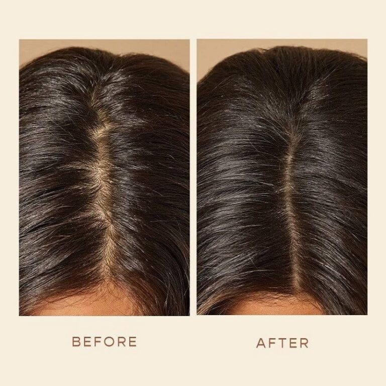 Vegamour Before and After Real Results or Hype? Must Read This Before Buying