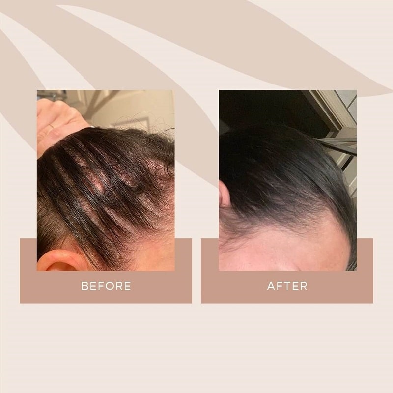 Vegamour Before and After: Real Results or Hype?