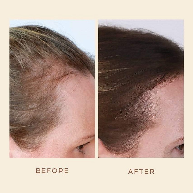 Vegamour Before and After: Real Results or Hype?