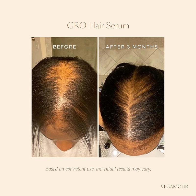 Vegamour Before and After: Real Results or Hype?