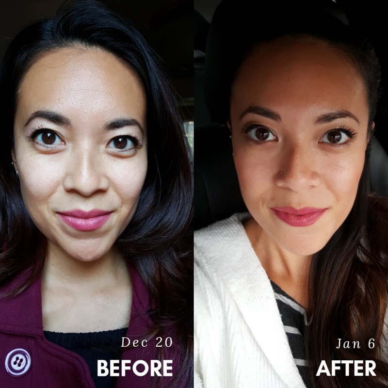 Modere Collagen Before and After: Real Results Revealed 3 Modere Collagen Before and After: Real Results Revealed