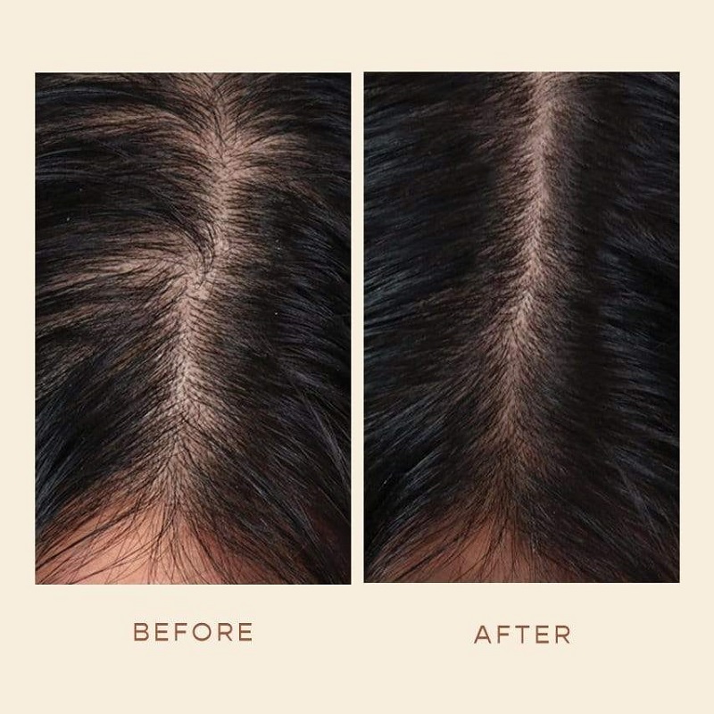 Vegamour Before and After: Real Results or Hype?
