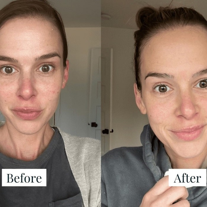 Solawave Before and After: A Comprehensive Analysis of the Results 26 Solawave Before and After: A Comprehensive Analysis of the Results