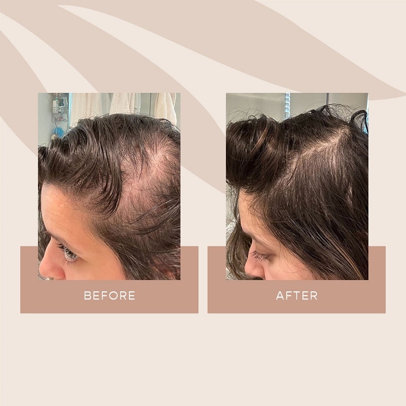 Vegamour Before and After: Real Results or Hype?