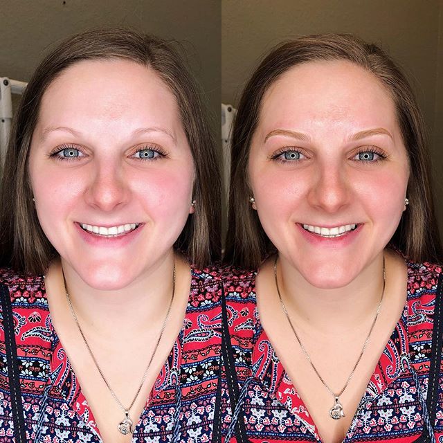 Microblading Before and After: Transforming Your Brows with Precision and Artistry