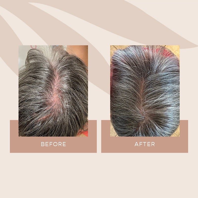 Vegamour Before and After: Real Results or Hype?