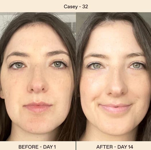 Solawave Before and After: A Comprehensive Analysis of the Results 32 Solawave Before and After: A Comprehensive Analysis of the Results