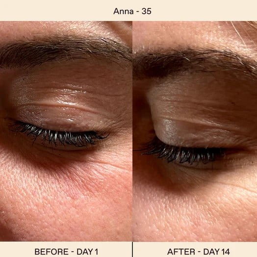 Solawave Before and After: A Comprehensive Analysis of the Results 33 Solawave Before and After: A Comprehensive Analysis of the Results