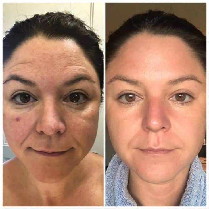 Modere Collagen Before and After: Real Results Revealed