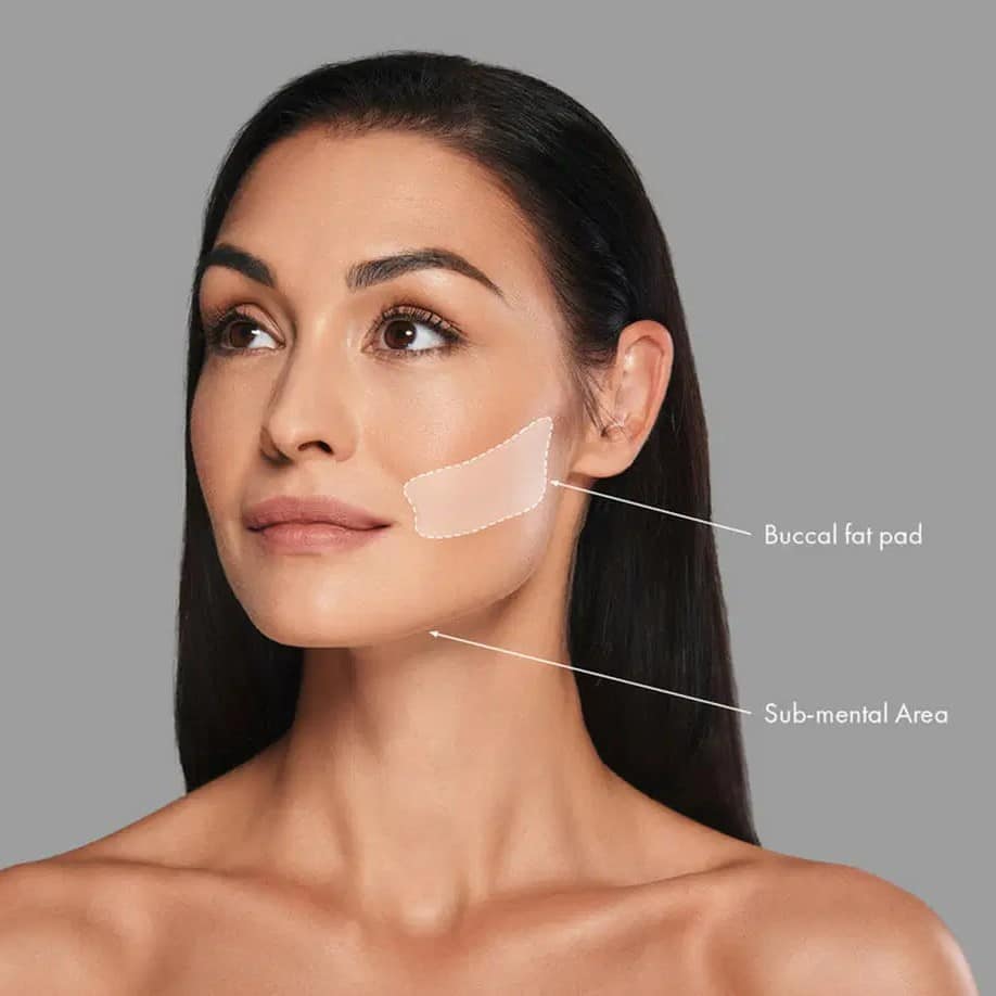 Buccal Fat Removal Before and After: What You Need to Know 1 Buccal Fat Removal Before and After: What You Need to Know