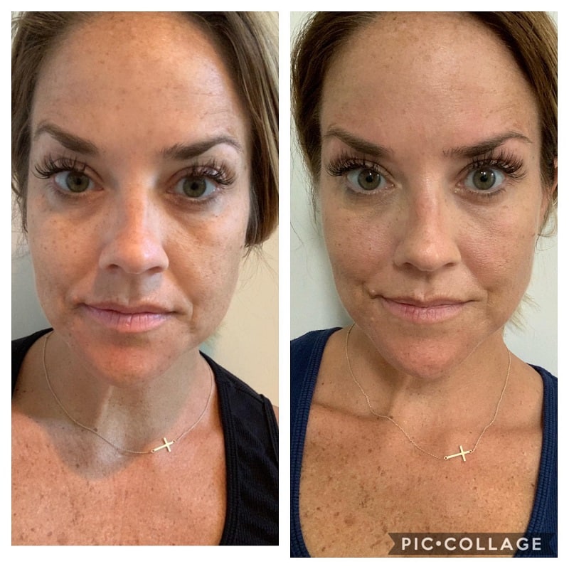 Modere Collagen Before and After: Real Results Revealed