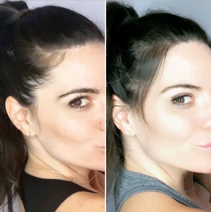 Modere Collagen Before and After: Real Results Revealed 7 Modere Collagen Before and After: Real Results Revealed