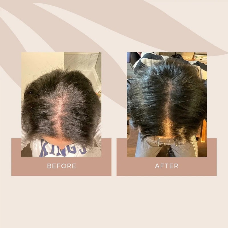 Vegamour Before and After: Real Results or Hype?