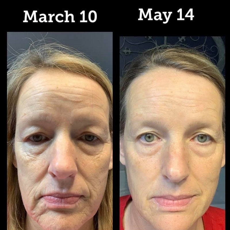 Modere Collagen Before and After: Real Results Revealed