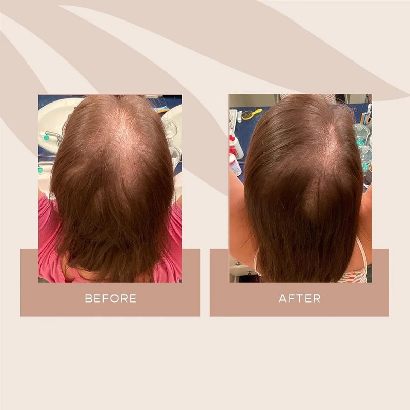 Vegamour Before and After: Real Results or Hype?