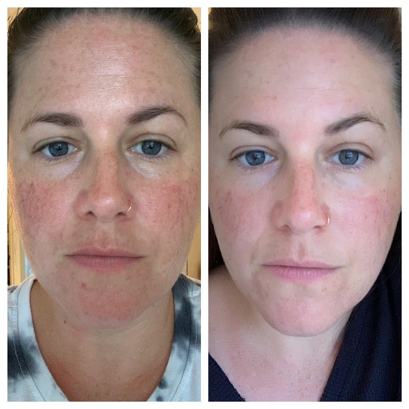 Modere Collagen Before and After: Real Results Revealed