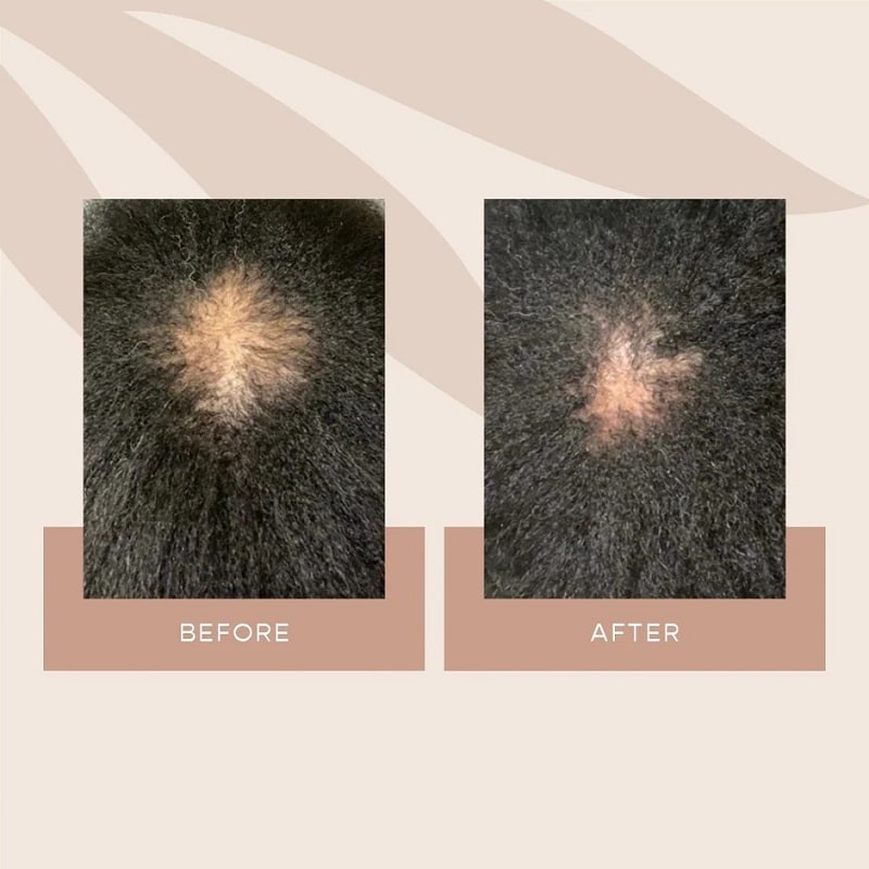 Vegamour Before and After: Real Results or Hype?