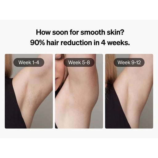 ULIKE Air 3 IPL Hair Removal System Review