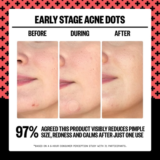 Peace Out Skincare Early-Stage Acne Dots Review