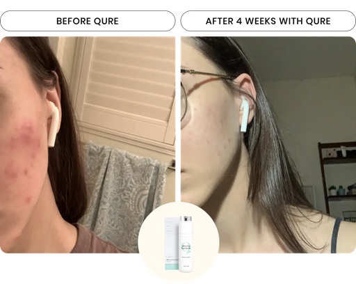 Qure Face Serum Review