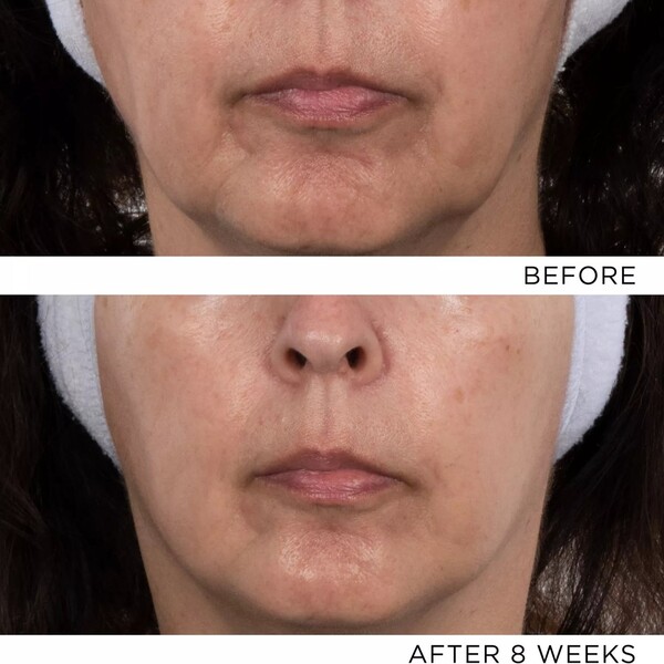 Noble Panacea Chronobiology Sleep Mask Review