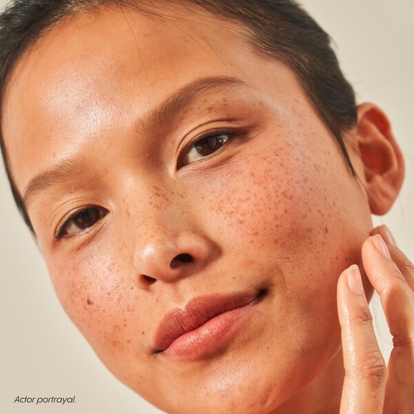 Nurx Skincare Review