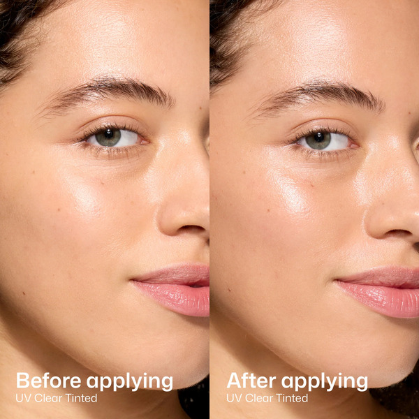 EltaMD Review: Why Dermatologists Keep Recommending It